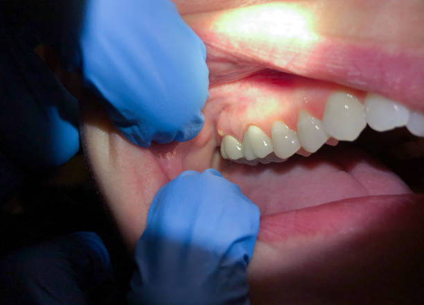 Best Emergency Gum Treatment in Williston Highlands, FL